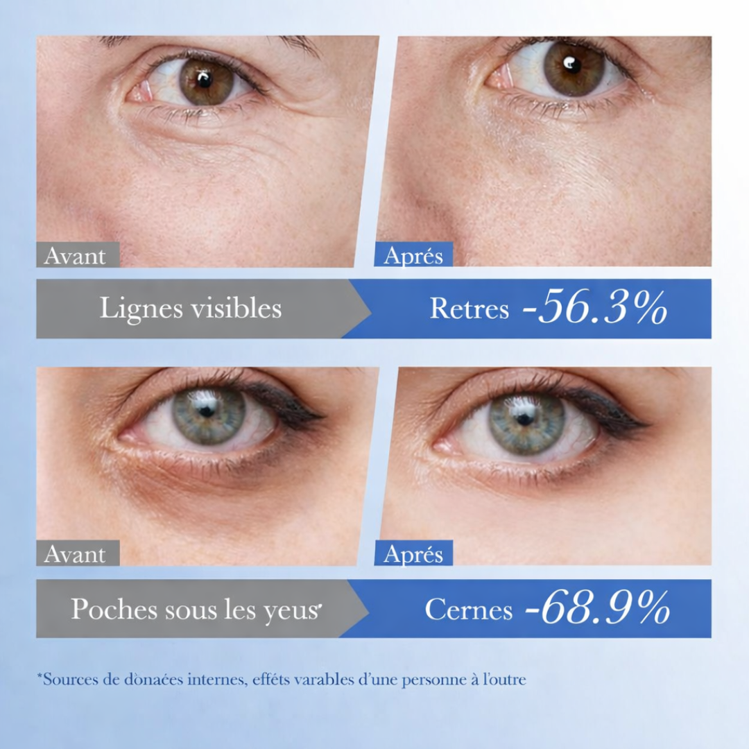 Crème Yeux Anti-Âge ORVELLA Caviar & Acide Hyaluronique